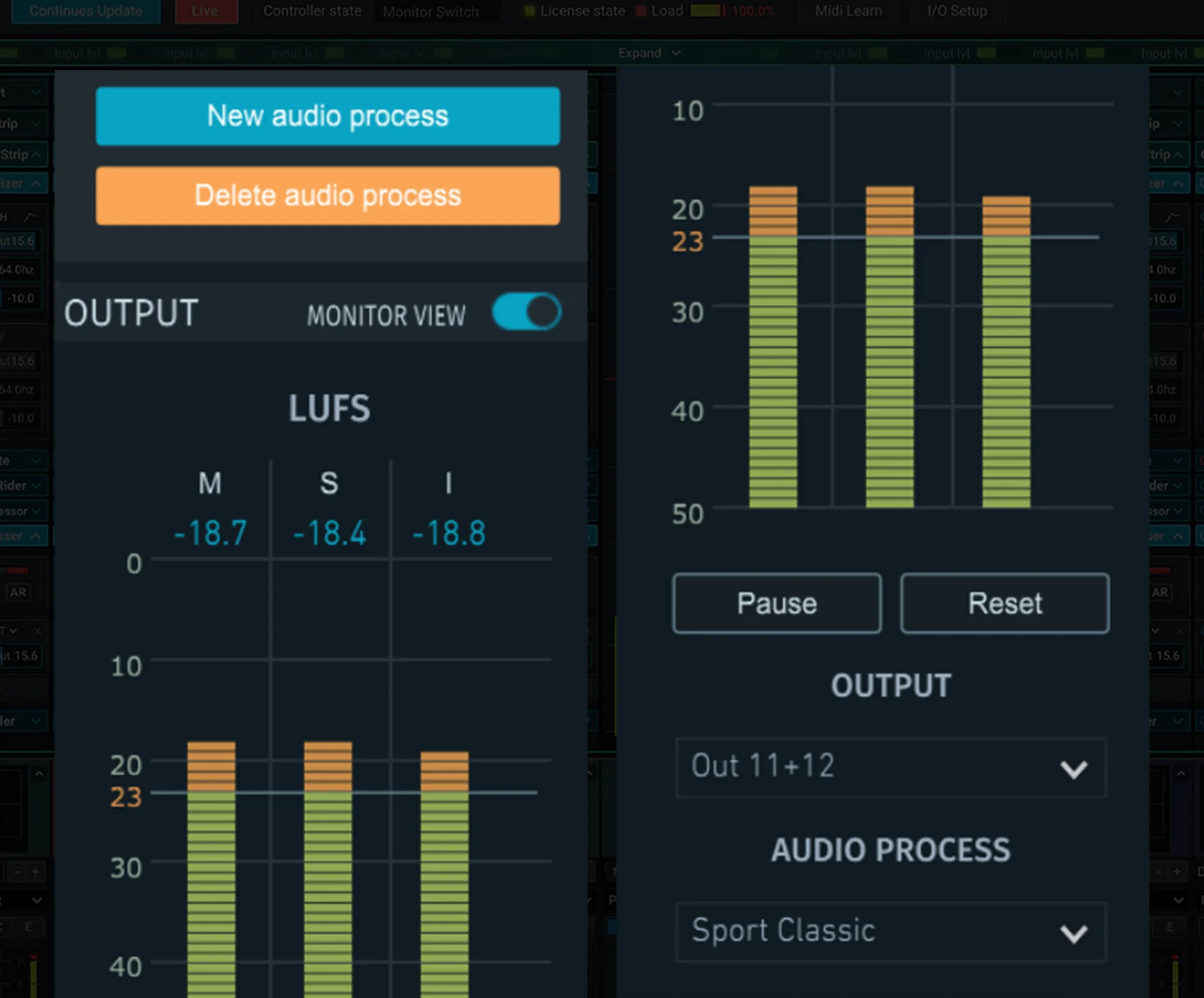 Loudness management